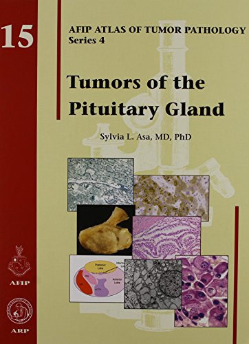 9781933477152: Tumors of the Pituitary Gland: No. 15 (AFIP Atlas of Tumor Pathology, Series 4,)