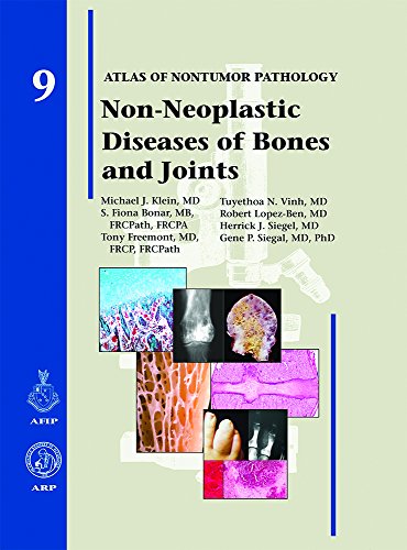 Beispielbild fr Non-Neoplastic Diseases of Bones and Joints (Atlas of Nontumor Pathology) zum Verkauf von Studibuch