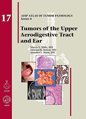 Imagen de archivo de Atlas of Tumor Pathology, 4th Series: Tumors of the Upper Aerodigestive Tract and Ear a la venta por ThriftBooks-Dallas