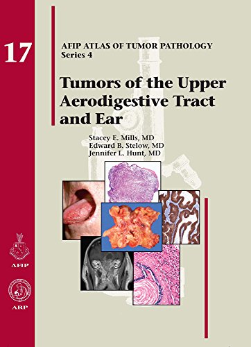 Stock image for Atlas of Tumor Pathology, 4th Series: Tumors of the Upper Aerodigestive Tract and Ear for sale by ThriftBooks-Dallas