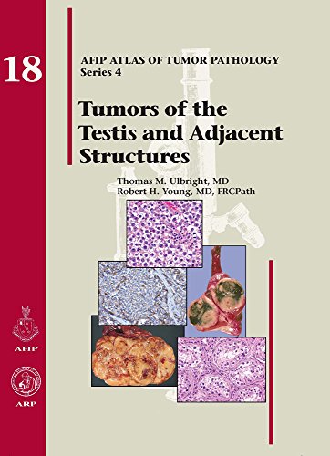 9781933477213: Tumors of the Testis and Adjacent Structures (AFIP Atlas of Tumor Pathology, Series 4)