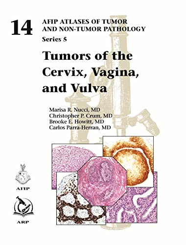 Stock image for Tumors of the Cervix, Vagina, and Vulva (AFIP Atlas of Tumor and Non-Tumor Pathology, Series 5) for sale by Revaluation Books
