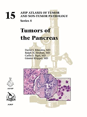 Stock image for Tumors of the Pancreas (AFIP Atlas of Tumor and Non-Tumor Pathology, Series 5) for sale by Revaluation Books