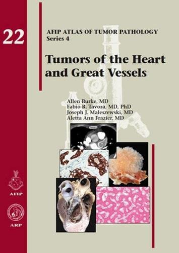 Imagen de archivo de Tumors of the Heart and Great Vessels (Atlas of Tumor Pathology) a la venta por HPB-Red