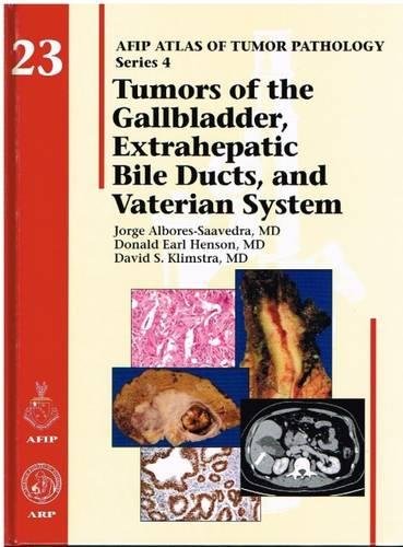 Imagen de archivo de Tumors of the Gallbladers Extrahepatic Bile Ducts, and Vaterien System (Atlas of Tumor Pathology) a la venta por Coas Books