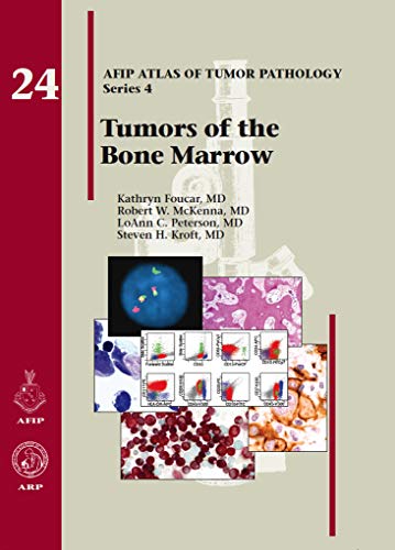 Beispielbild fr TUMORS OF THE BONE MARROW (4F24) zum Verkauf von St Vincent de Paul of Lane County