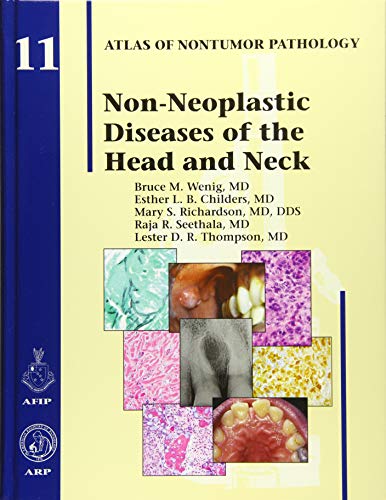 Imagen de archivo de Non-Neoplastic Diseases of the Head and Neck (Atlas of Nontumor Pathology, Series 1, Number 11) a la venta por ThriftBooks-Atlanta