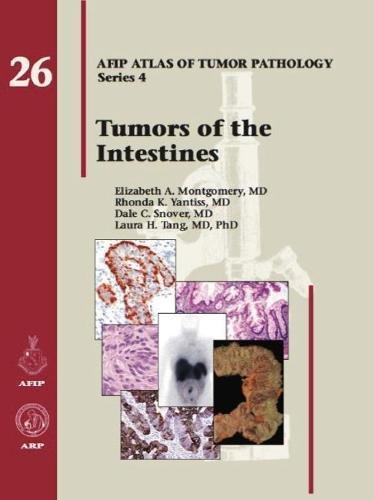 Stock image for Tumors of the Intestines (Atlas of Tumor Pathology, Series 4, Number 26) for sale by ThriftBooks-Atlanta
