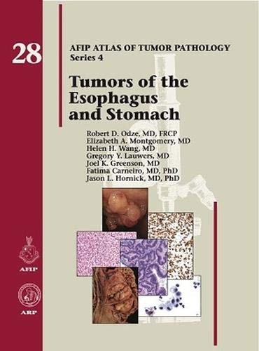 Imagen de archivo de Tumors of the Esophagus and Stomach (AFIP Atlas of Tumor Pathology, Series 4,) a la venta por HPB-Red