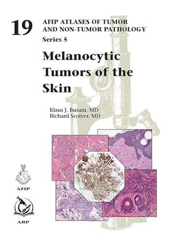 Imagen de archivo de Melanocytic Tumors of Skin a la venta por PBShop.store US