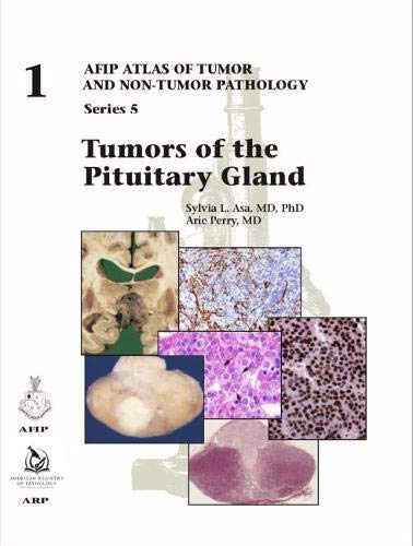 Imagen de archivo de Tumors Of The Pituitary Gland a la venta por Revaluation Books
