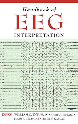 Beispielbild fr Handbook of EEG Interpretation zum Verkauf von Better World Books Ltd