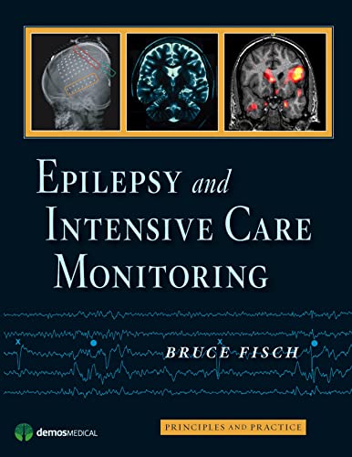 9781933864136: Epilepsy and Intensive Care Monitoring: Principles and Practice