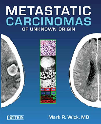 Imagen de archivo de Metastatic Carcinomas of Unknown Origin a la venta por Better World Books Ltd