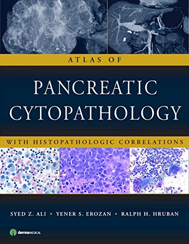 Stock image for Atlas of Pancreatic Cytopathology: With Histopathologic Correlations for sale by ZBK Books
