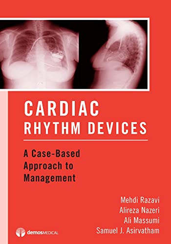 Stock image for Cardiac Rhythm Devices: A Case-Based Approach to Management for sale by HPB-Red