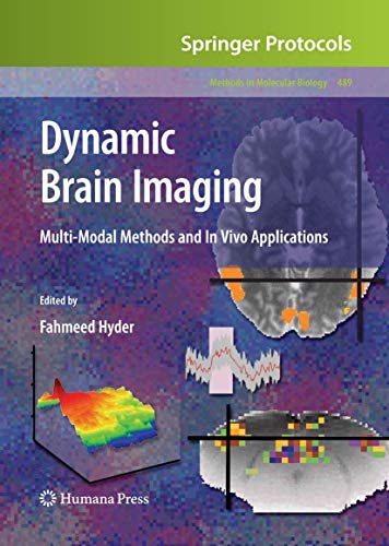 Dynamic Brain Imaging. Multi-Modal Methods and In Vivo Applications