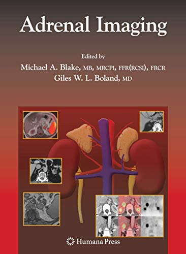 9781934115862: Adrenal Imaging (Contemporary Medical Imaging)