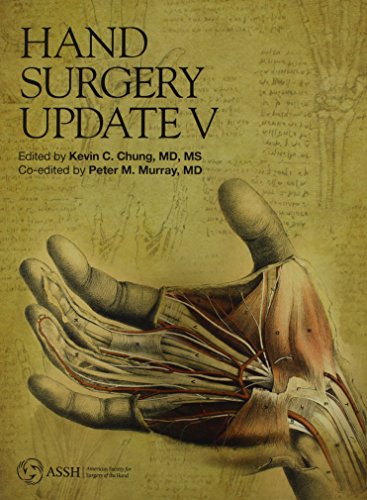 Beispielbild fr Hand Surgery Update V zum Verkauf von HPB-Red