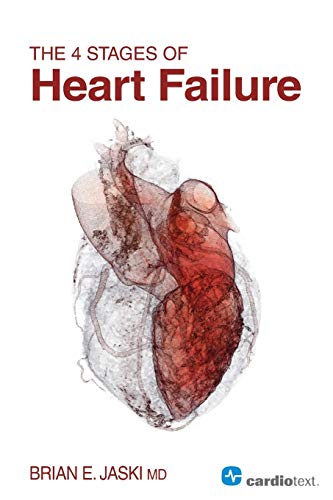 Beispielbild fr 4 Stages of Heart Failure zum Verkauf von BooksRun