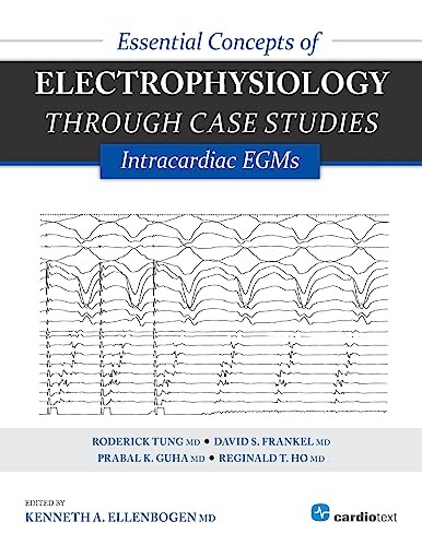 9781935395331: Essential Concepts of Electrophysiology Through Case Studies: Intracardiac EGMs : Intracardiac EGMs