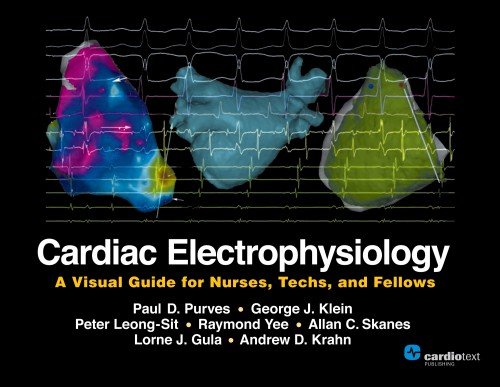 Imagen de archivo de Cardiac Electrophysiology: A Visual Guide for Nurses, Techs, and Fellows a la venta por Books Unplugged