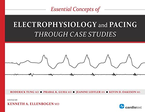 Beispielbild fr Essential Concepts of Electrophysiology and Pacing through Case Studies zum Verkauf von AwesomeBooks