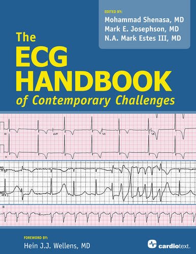 Stock image for ECG Handbook of Contemporary Challenges for sale by GF Books, Inc.
