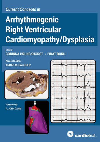 9781935395928: Current Concepts in Arrhythmogenic Right Ventricular Cardiomyopathy/Dysplasia