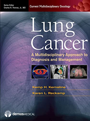 Stock image for Lung Cancer: A Multidisciplinary Approach to Diagnosis and Management for sale by ThriftBooks-Dallas