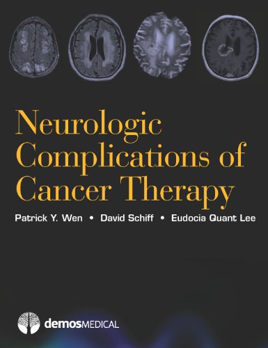 Stock image for Neurologic Complications of Cancer Therapy for sale by HPB-Red
