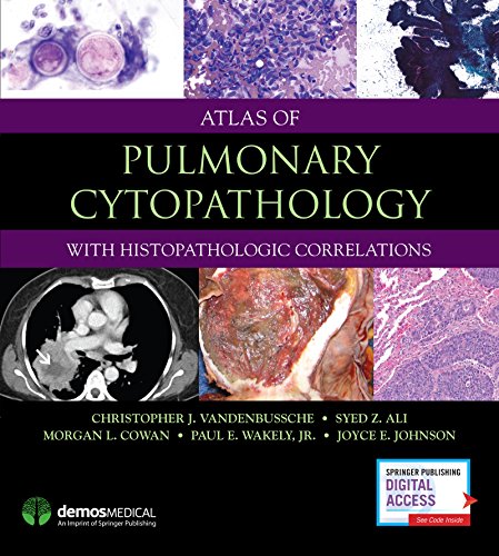 Stock image for Atlas of Pulmonary Cytopathology for sale by Upward Bound Books