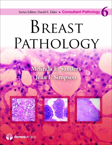 9781936287680: Breast Pathology: 6 (Consultant Pathology, Volume 6)