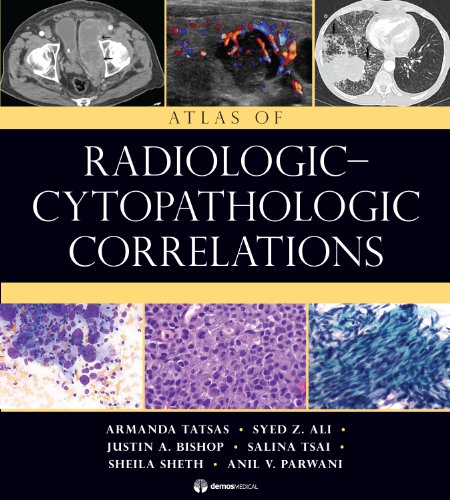 Beispielbild fr Atlas of Radiologic-Cytopathologic Correlations zum Verkauf von suffolkbooks