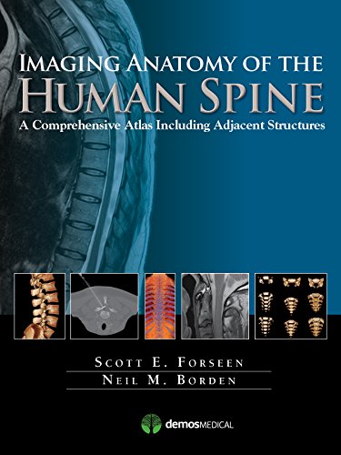 Beispielbild fr Imaging Anatomy of the Human Spine: A Comprehensive Atlas Including Adjacent Structures zum Verkauf von ThriftBooks-Atlanta