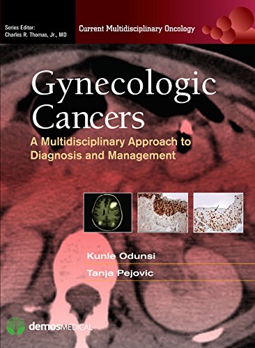 Stock image for Gynecologic Cancers: A Multidisciplinary Approach to Diagnosis and Management (Current Multidisciplinary Oncology) for sale by Lucky's Textbooks