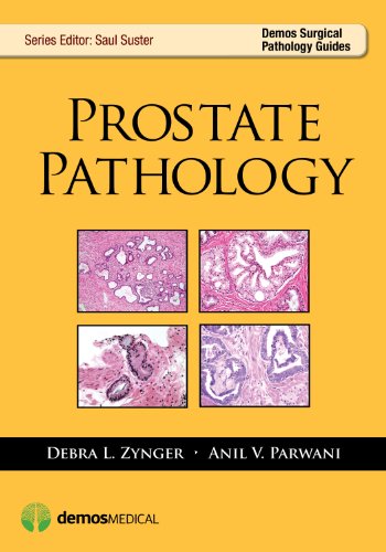 9781936287901: Prostate Pathology (Demos Surgical Pathology Guides)