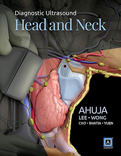 Beispielbild fr Diagnostic Ultrasound: Head and Neck zum Verkauf von SecondSale