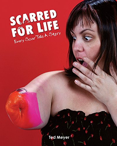 Stock image for Scarred for Life: Every Scar Tells a Story for sale by Books From California