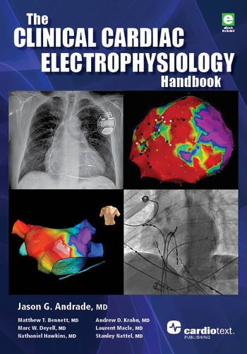 Beispielbild fr The Clinical Cardiac Electrophysiology Handbook zum Verkauf von Wonder Book