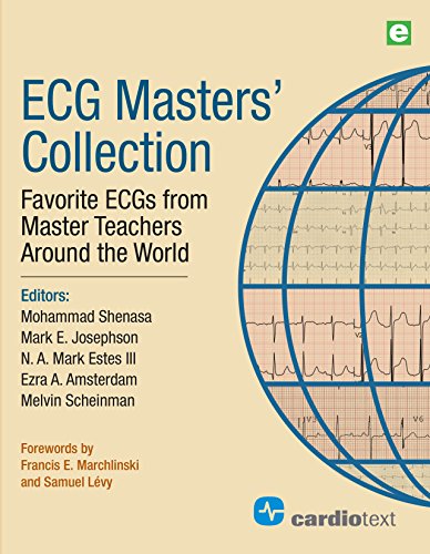 Beispielbild fr ECG Masters Collection: Favorite ECGs from Around the World zum Verkauf von Books Unplugged