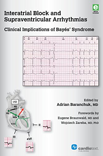 Beispielbild fr Interatrial Block and Supraventricular Arrhythmias: Clinical Implications of Bayes' Syndrome zum Verkauf von Wizard Books