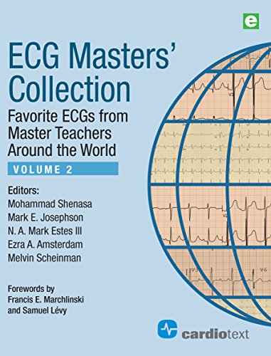 Beispielbild fr ECG Masters' Collection, Volume 2: Favorite ECGs from Master Teachers Around the World zum Verkauf von Byrd Books