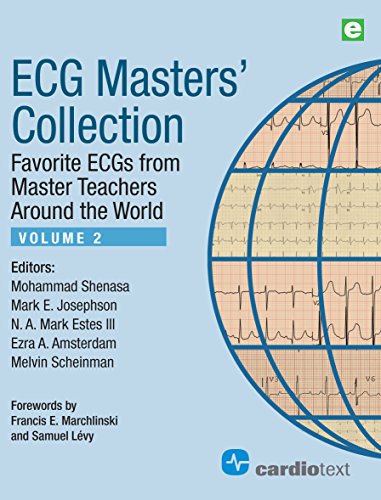 Stock image for ECG Masters' Collection, Volume 2: Favorite ECGs from Master Teachers Around the World for sale by Book Deals
