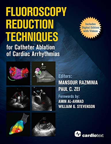 Beispielbild fr Fluoroscopy Reduction Techniques for Catheter Ablation of Cardiac Arrhythmias zum Verkauf von BooksRun