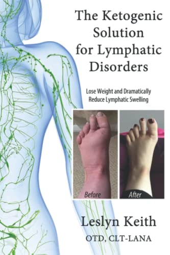 Imagen de archivo de The Ketogenic Solution for Lymphatic Disorders: A Proven Way to Lose Weight and Reduce Lymphatic Swelling a la venta por Goodwill Books