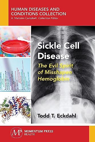 Stock image for Sickle Cell Disease: The Evil Spirit of Misshapen Hemoglobin for sale by suffolkbooks