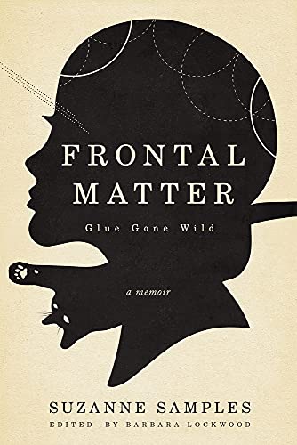 Beispielbild fr Frontal Matter: Glue Gone Wild zum Verkauf von GF Books, Inc.