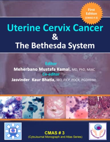 Stock image for Uterine Cervix Cancer The Bethesda System: CMAS # 3 for sale by Books Unplugged