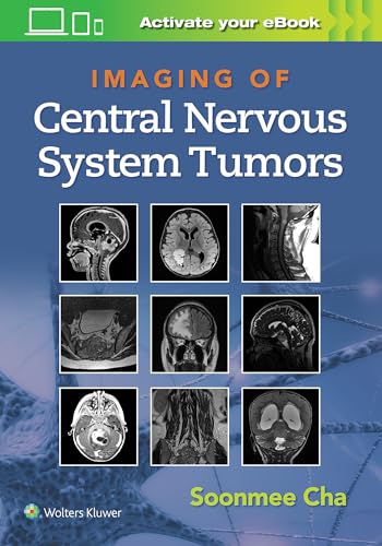 Beispielbild fr Imaging of Central Nervous System Tumors zum Verkauf von BooksRun
